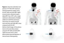 PET imaging