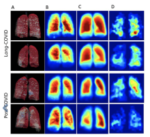 Here is a rundown of what you and your colleagues found to be most interesting in the field of medical imaging during the month of October including #COVID-19 coverage