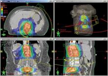  ASTRO, radiation therapy, proton therapy