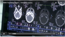 radiology videos, video, ITNtv, ITN TV