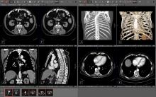 Visage 7 has advanced enterprise imaging based on the proven ability to replace legacy PACS for imaging organizations of all sizes and local, regional or national scale.