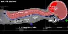 Imaging Considerations for Proton Therapy Treatment Planning