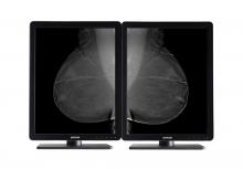 Flat panel displays, barco nio, mammography