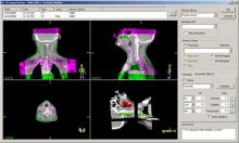 treatment planning system, elekta, aapm