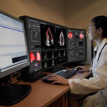 cardio-oncology, echo strain assessment, echoinsight, epsilon