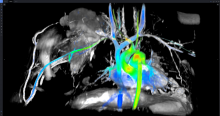 ViosWorks, cardiac MRI