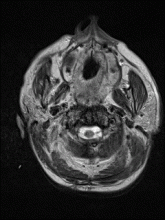 A static image drawn from a stack of brain MR images may illustrate the results of a study. But a GIF (or MP4 movie), created by the Cinebot plug-in, can scroll through that stack, providing teaching moments for residents and fellows at Georgetown University