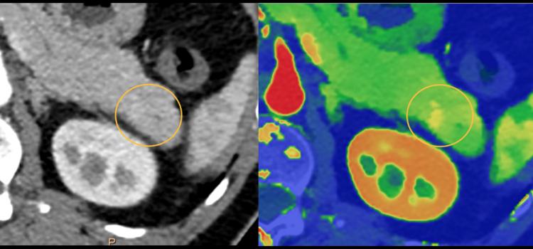 Computed Tomography Ct Imaging Technology News