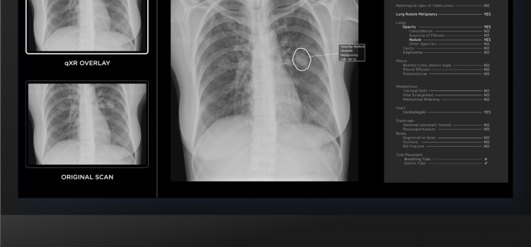 radiographer x rays